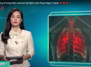 Ứng dụng AI trong tầm soát lao tại Bệnh viện Phạm Ngọc Thạch