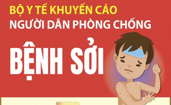 TỔNG HỢP NHỮNG ĐIỀU CẦN BIẾT VỀ BỆNH SỞI