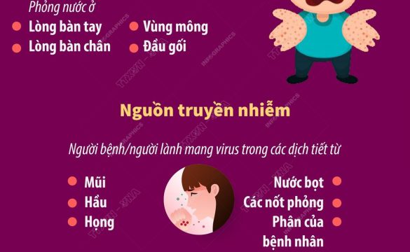 Bệnh tay chân miệng: Dấu hiệu nhận biết và nguồn truyền bệnh